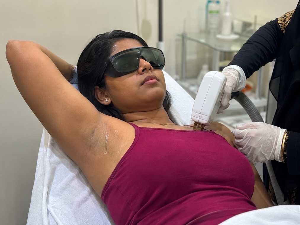 Laser Hair Removal
