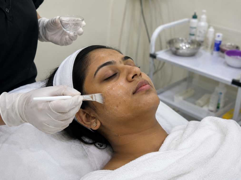 Chemical Peels