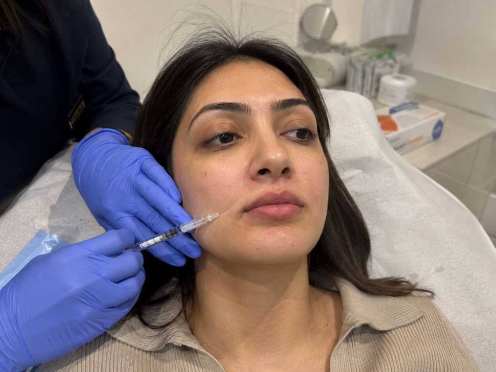 Fillers