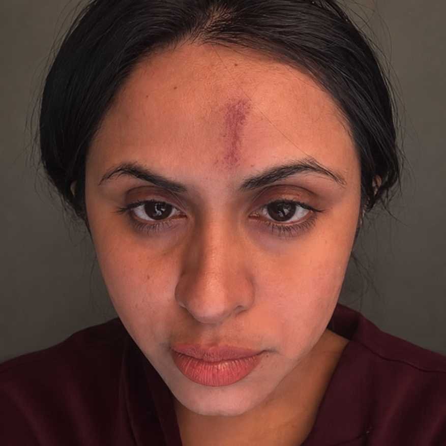 Before treatment