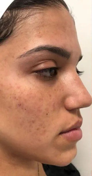 Before treatment