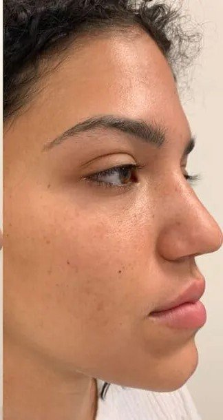 After treatment